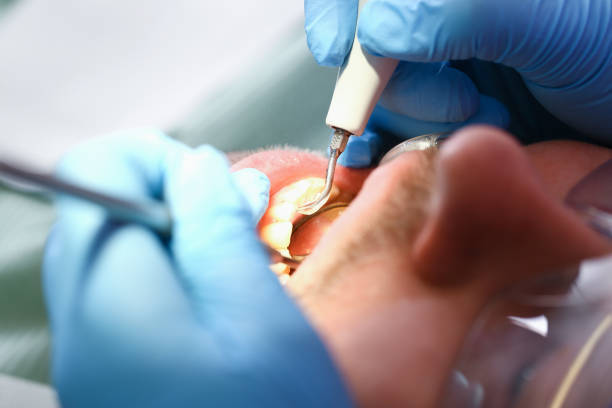 Best Urgent Care for Lost Fillings or Crowns in Valhalla, NY